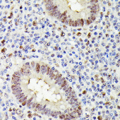 MLH1 Mouse mAb (A20544)