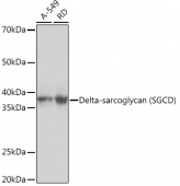 Delta-sarcoglycan (SGCD) Rabbit mAb (A9175)