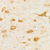 DARPP32 Rabbit mAb (A22664)