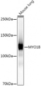 MYO1B Rabbit mAb (A21113)