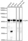 Epsin 1 Rabbit mAb (A20872)