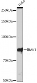 IRAK1 Rabbit mAb (A4439)