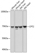 CPT2 Rabbit mAb (A0653)