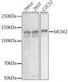 MCM2 Rabbit mAb (A20699)
