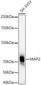 MAP2 Rabbit mAb (A22205)