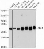 SDHB Rabbit mAb (A1809)
