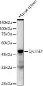 Cyclin E1 Rabbit mAb (A22360)
