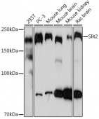 Slit2 Rabbit mAb (A3467)