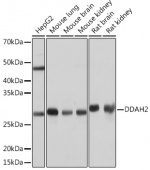 DDAH2 Rabbit mAb (A4159)