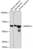 SERPINC1 Rabbit mAb (A11249)