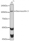 Desmocollin 3 Rabbit mAb (A0445)