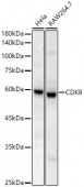 CDK8 Rabbit mAb (A23765)