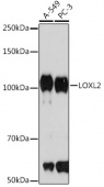 LOXL2 Rabbit mAb (A4708)