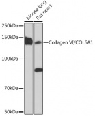 Collagen VI/COL6A1 Rabbit mAb (A9738)