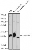 Caveolin-3  Rabbit mAb (A4891)