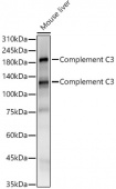 Complement C3 Rabbit mAb (A22265)