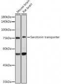 Serotonin transporter Rabbit mAb (A22413)