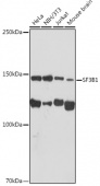 SF3B1 Rabbit mAb (A9737)
