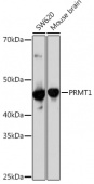 PRMT1 Rabbit mAb (A4502)