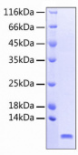 Recombinant Human CCL5/RANTES Protein (RP00321)