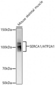 SERCA1/ATP2A1 Rabbit mAb (A22614)