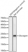 Glucagon Rabbit mAb (A22702)