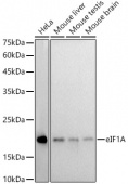 eIF1A Rabbit mAb (A20954)