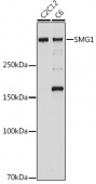 SMG1 Rabbit mAb (A19253)