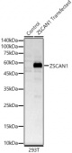 ZSCAN1 Rabbit pAb (A16639)