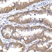 SFT Rabbit mAb (A21076)