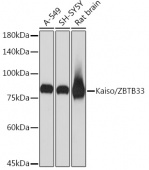 Kaiso/ZBTB33 Rabbit mAb (A3770)