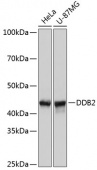 DDB2 Rabbit mAb (A11615)