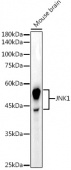 JNK1 Rabbit mAb (A23206)
