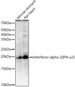 Interferon alpha 2 (IFN-α2) Rabbit mAb (A22098)
