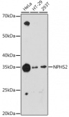 NPHS2 Rabbit mAb (A2302)