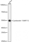 Cytokeratin 17 (KRT17) Rabbit mAb (A3769)