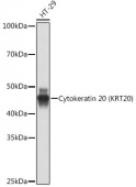 Cytokeratin 20 (CK20) Rabbit mAb (A19041)