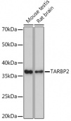 TARBP2 Rabbit mAb (A9105)