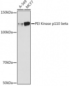 PI3 Kinase p110 beta Rabbit mAb (A1271)