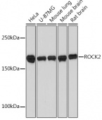ROCK2 Rabbit mAb (A2395)