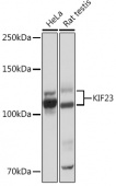 KIF23 Rabbit mAb (A4896)