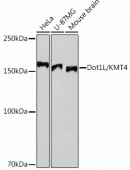 Dot1L/KMT4 Rabbit mAb (A12329)