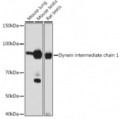 Dynein intermediate chain 1 Rabbit mAb (A3624)