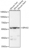 EPHX2 Rabbit mAb (A20920)