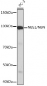 NBS1/NBN Rabbit mAb (A4197)