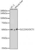 SLC22A3/OCT3 Rabbit mAb (A19758)