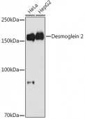 Desmoglein 2 Rabbit mAb (A4489)
