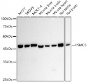PSMC5 Rabbit mAb (A20969)