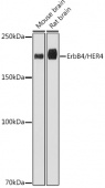 ErbB4/HER4 Rabbit mAb (A19047)