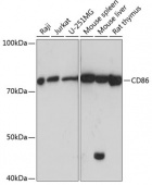 CD86 Rabbit mAb (A19026)